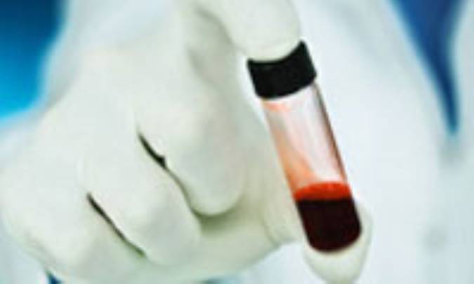 راهنماي تفسير نتايج آزمايش خون