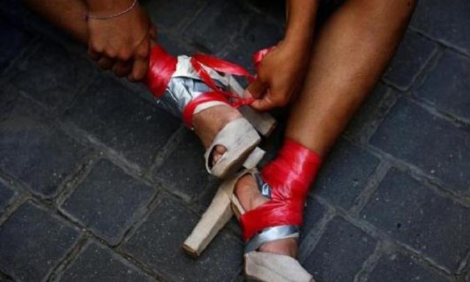 هرآنچه که باید راجع به اختلال مبدل پوشی بدانیم