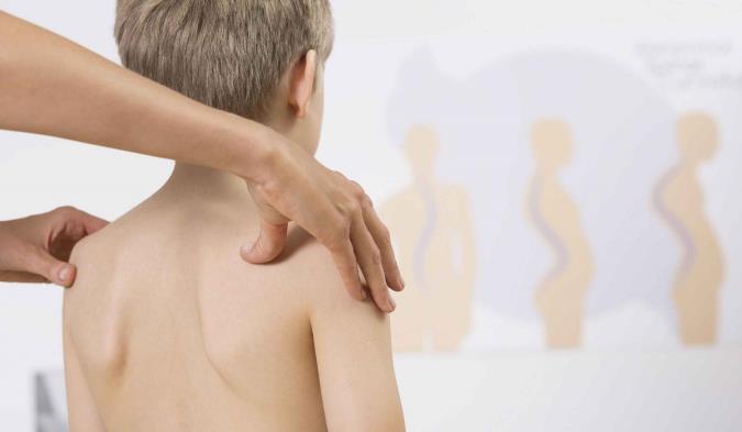 اسکولیوز چیست و چگونه درمان میشود؟