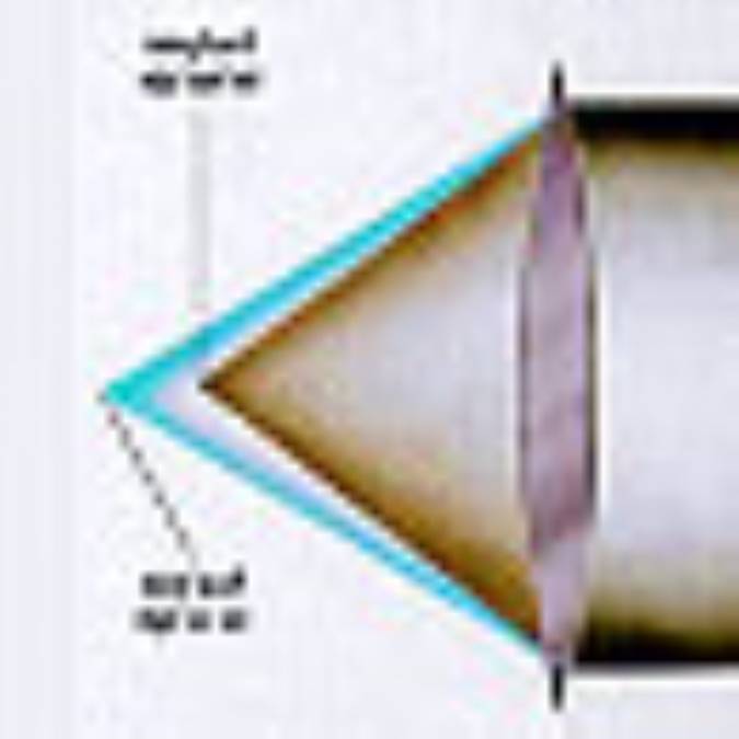 ابیراهی کروی