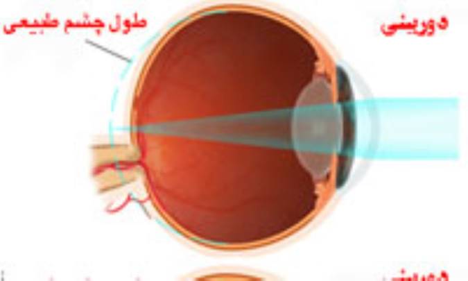 انواع دوربيني 