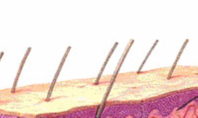 پوست هاي ترکيبي به پوست هايي گفته مي شود که مخلوطي از پوست هاي چرب و خشک هستند