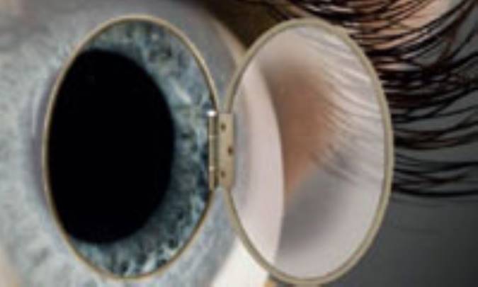 چه موقع مجبور به پیوند قرنیه می‌شویم؟