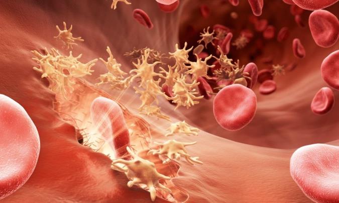 راجع به بیماری هموفیلی چه میدانید؟