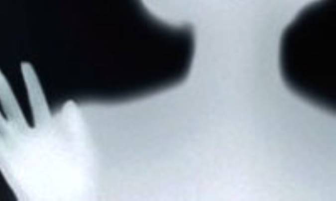 درد قاعدگى يا ديسمنوره 