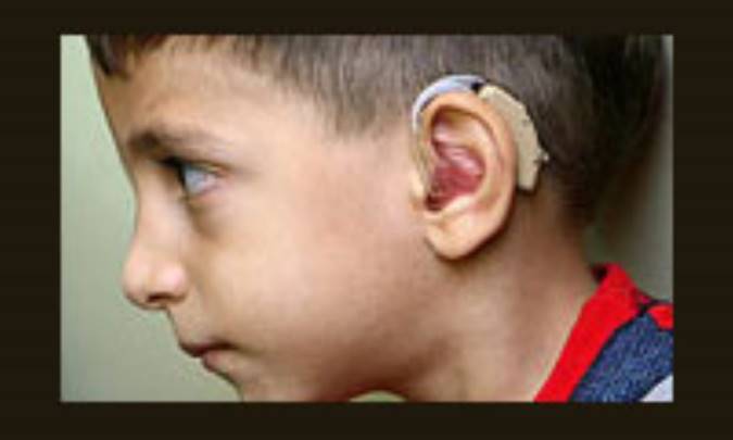 روان‌شناسي ناشنوايان