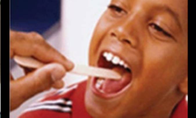 گلودرد فرزندتان را جدي بگيريد