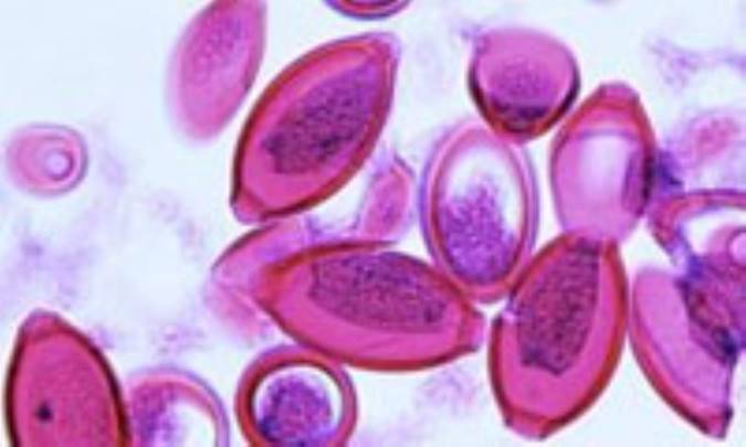 برخي مشكلات شايع روده اي