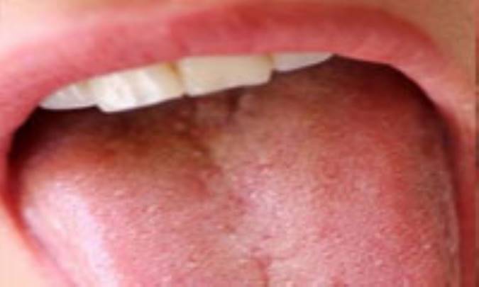 تنفس دهاني، قيافه را عوض مي‌کند!