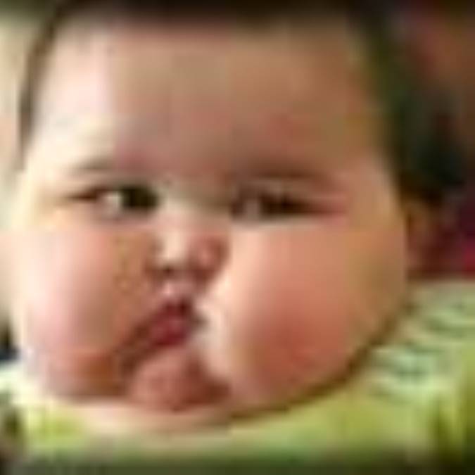 چاقي در کودکان