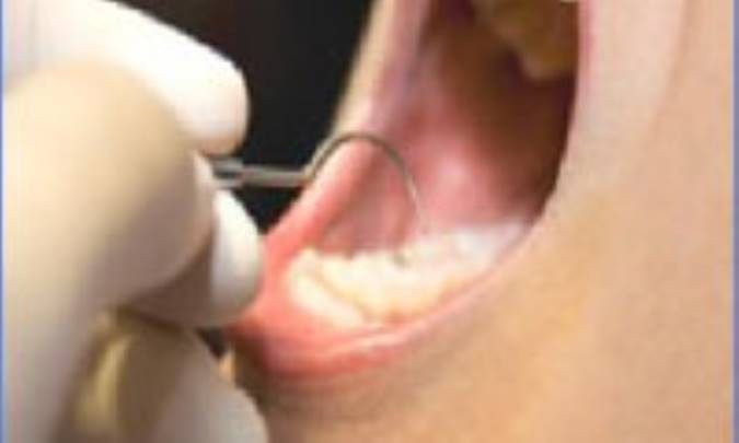 دانش‌آموزان و بهداشت دهان و دندان