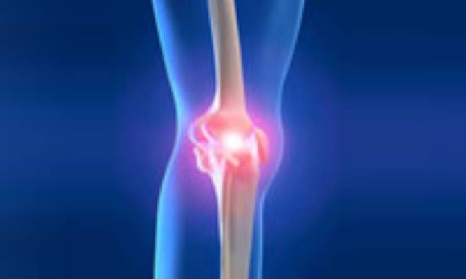 زانودرد امانتان را بريده؟