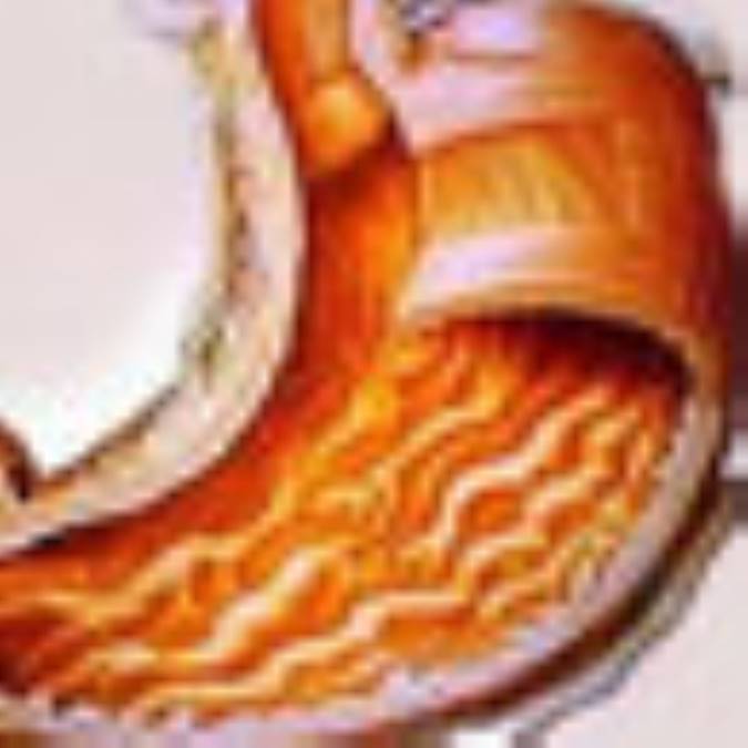 عيدتان مبارک ؛ گاستريت نگيريد!