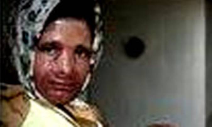 اگر صورت‌تان سوخت، بخوانيد