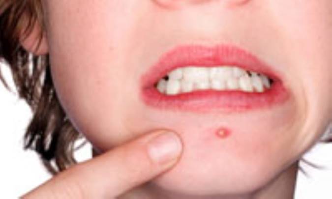 مزاحمان کوچک پوست شما....(1)