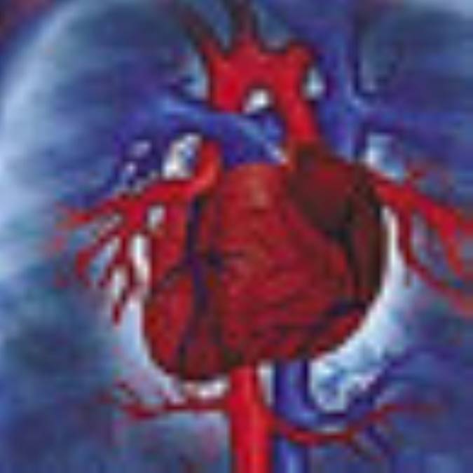 حمله قلبي- Heart Attack