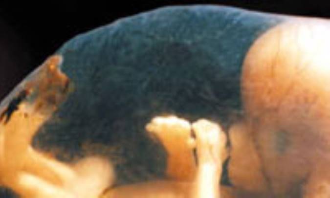 ناهنجاري کروموزمي، عامل نيمي از سقط‌ها