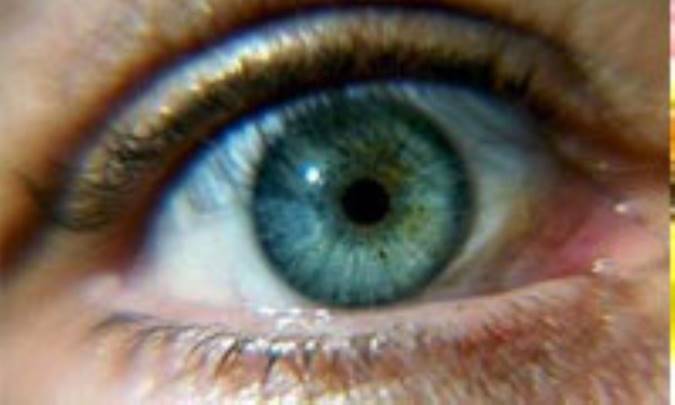 بيماري‌هاي چشمي و باورهاي غلط