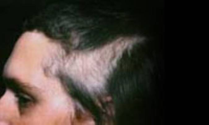 اعصاب با پوست چه مي‌کند؟