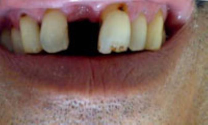 افتاد و دندونش شكست...