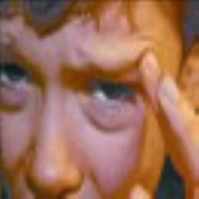 میگرن در کودکان