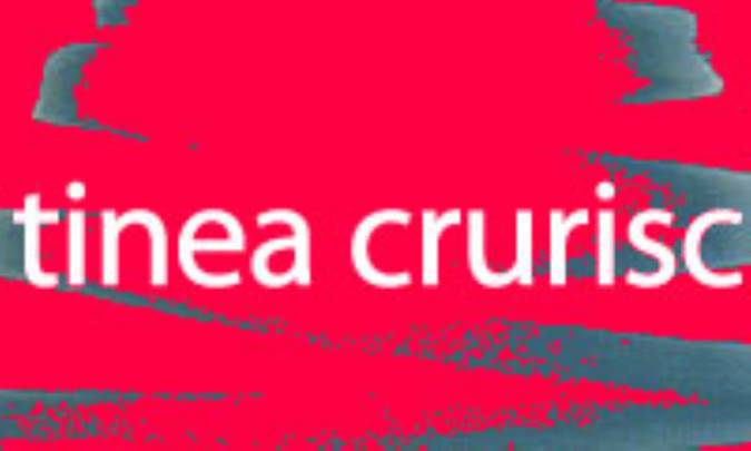 كچلي‌ كشاله‌ ران‌ (تيناكروريس‌)*