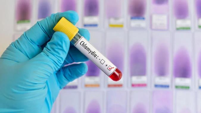 کلامیدیا چیست، همه چیز درباره ی علائم، عوارض و راه های درمان آن