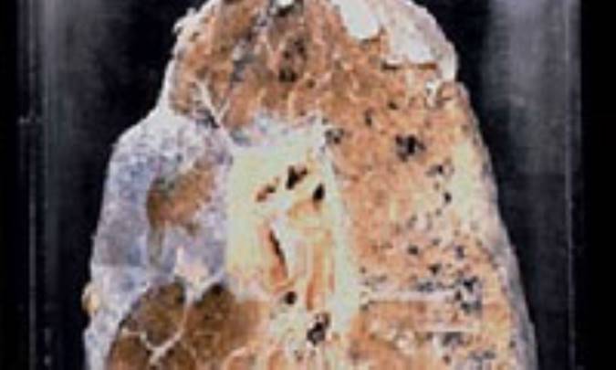 آزبستوز