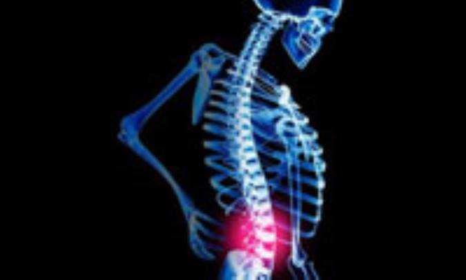 گودي ستون فقرات