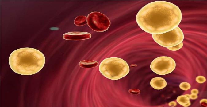 همه چیز درباره چربی خون بالا