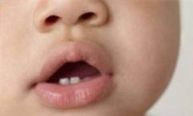 دردسرهاي دندان درآوردن