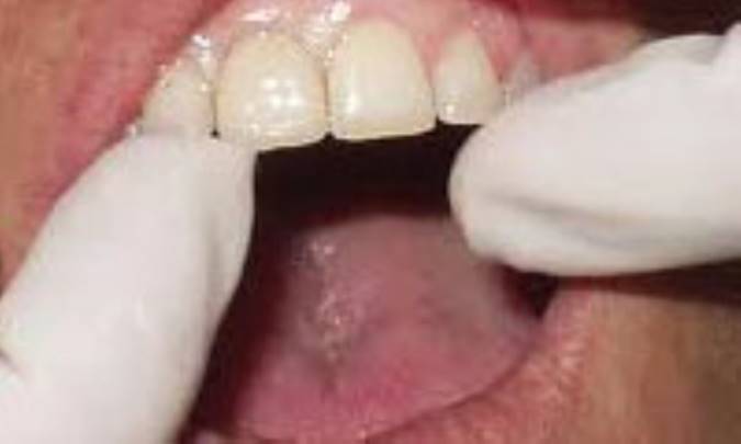 سؤالات شايع راجع به ارتودنسي