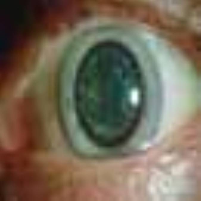 آب‌ مرواريد