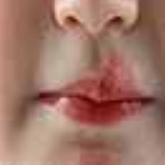 تبخال، مهمان ناخوانده