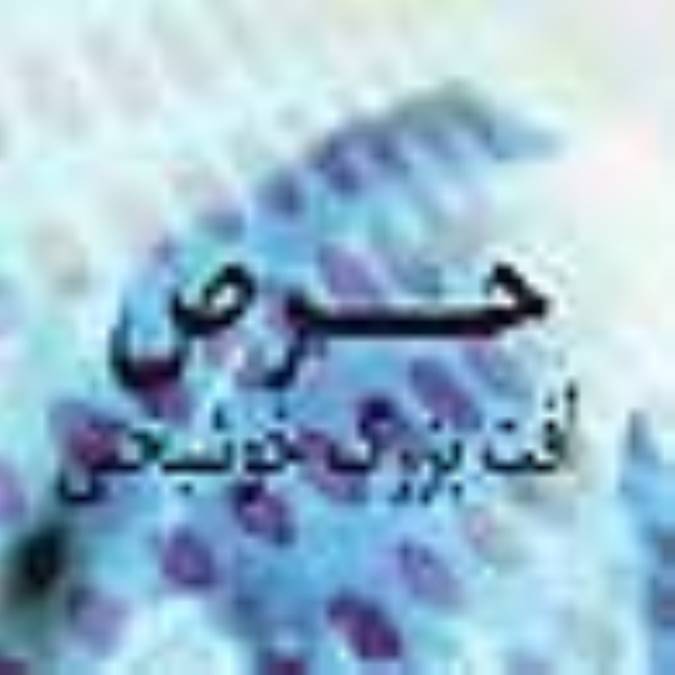 حرص، آفت‏بزرگ خوشبختی