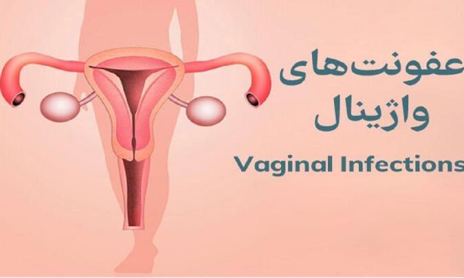 عفونت های واژینال ، از علل بروز تا راه های پیشگیری و درمان آن
