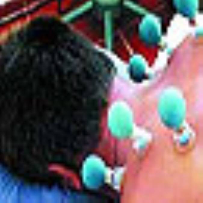 حجامت ، سنتي فراموش شده