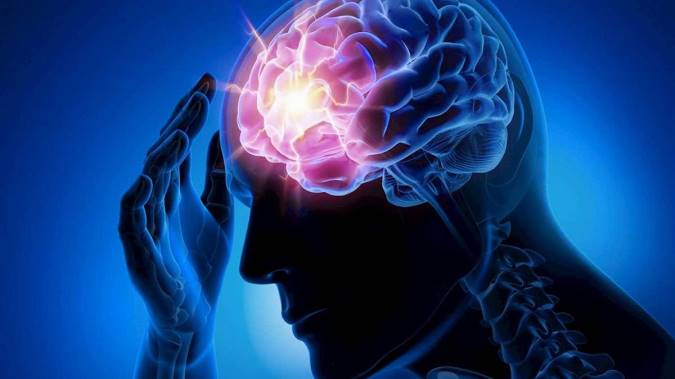 در مورد صرع چه می دانید؟