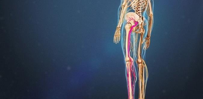 علت درد سیاتیک، علایم ، راه های تشخیص و درمان آن