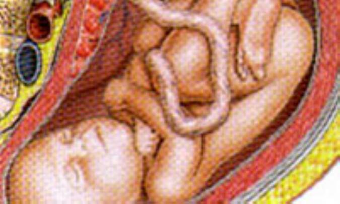 بررسي علل حاملگي هاي ناخواسته