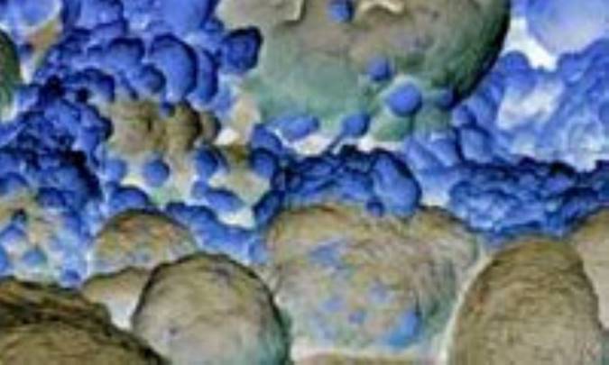 سرطان سينه چيست؟