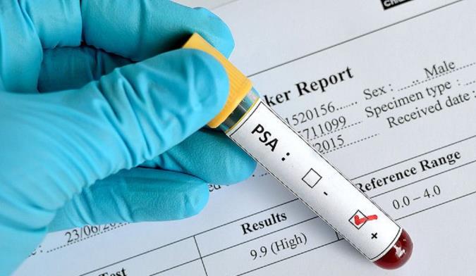 هر آنچه باید در مورد آزمایش پروستات، مزایا و معایب آن بدانید
