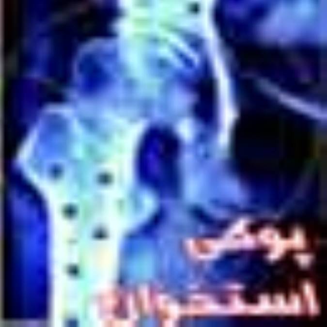 علايم شايع پوكي استخوان
