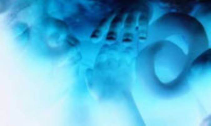 نشانگان بچه آبي