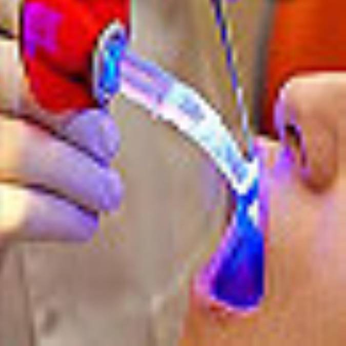 اثرات لیزر در دندانپزشکی