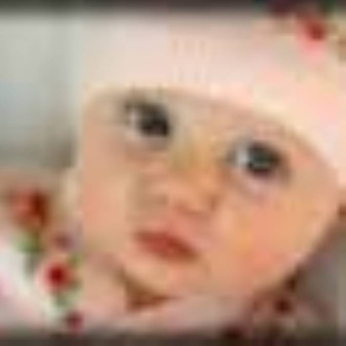 پاياني بر عارضه ي نازايي