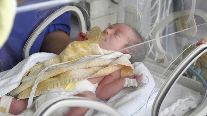 بررسی آپنه و برادیکاردی در نوزادان زودرس