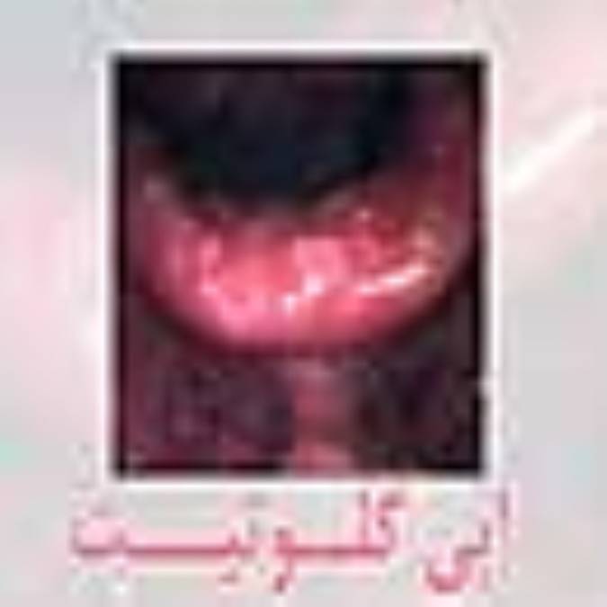 اپي‌گلوتيت‌ (Epiglottitis)