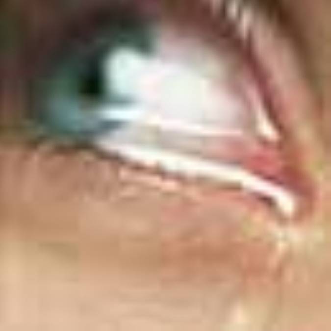 ترنم انتظار