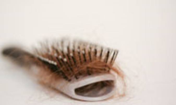 علل ريزش مو